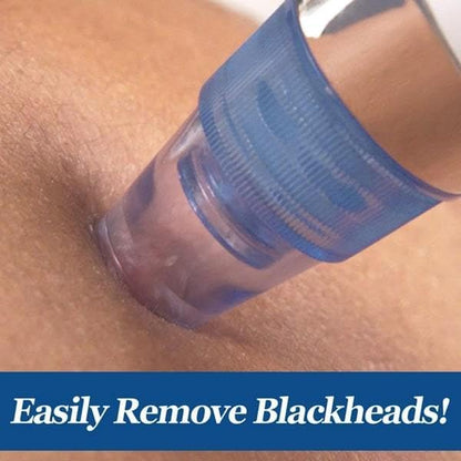 High-quality image showing the suction heads and device design
